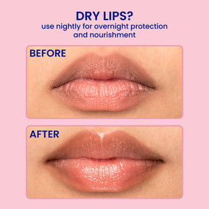 Gel Lip Mask - Korean Beauty - Sleeping - Berry Jam